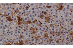 Immunohistochemistry of paraffin-embedded Rat liver using PRKD3 Polyclonal Antibody at dilution of 1:200 (PRKD3 antibody)