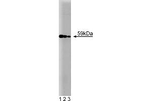 Western Blotting (WB) image for anti-V-Akt Murine Thymoma Viral Oncogene Homolog 1 (AKT1) antibody (ABIN968218) (AKT1 antibody)