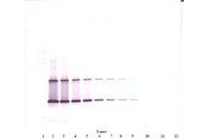 Image no. 1 for anti-Ciliary Neurotrophic Factor (CNTF) antibody (ABIN1497554) (CNTF antibody)