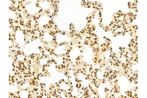ABIN6266019 and ABIN6273346 at 1/100 staining Rat lung tissue by IHC-P. (WDR18 antibody  (Internal Region))