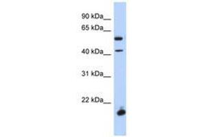 Image no. 1 for anti-Developing Brain Homeobox 1 (DBX1) (AA 248-297) antibody (ABIN6741082) (DBX1 antibody  (AA 248-297))