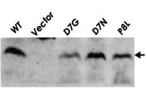Detection of RuvC (19kD) proteins in the cell extracts of E. (RuvC antibody)