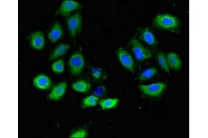 Immunofluorescent analysis of A549 cells using ABIN7163717 at dilution of 1:100 and Alexa Fluor 488-congugated AffiniPure Goat Anti-Rabbit IgG(H+L)