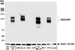 Western Blotting (WB) image for anti-Carcinoembryonic Antigen-Related Cell Adhesion Molecule 1 (CEACAM1) (AA 35-433) antibody (ABIN7455148)