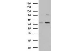 HEK293T cells were transfected with the pCMV6-ENTRY control (Left lane) or pCMV6-ENTRY CBWD1 (Right lane) cDNA for 48 hrs and lysed. (CBWD1 antibody)