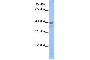 WB Suggested Anti-VPS26B Antibody Titration: 0. (VPS26B antibody  (C-Term))
