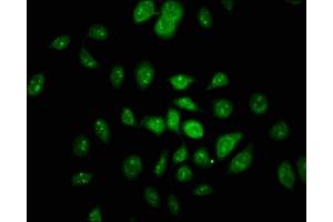 Immunofluorescence staining of A549 cells with ABIN7161270 at 1:100, counter-stained with DAPI. (Neurofibromin 1 antibody  (AA 655-892))