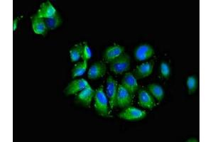 Immunofluorescent analysis of A549 cells using ABIN7147247 at dilution of 1:100 and Alexa Fluor 488-congugated AffiniPure Goat Anti-Rabbit IgG(H+L) (CADM3 antibody  (AA 140-328))