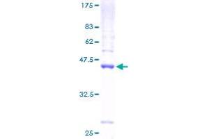 C1D Protein (AA 1-141) (GST tag)