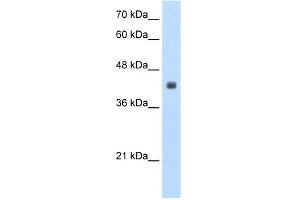 WB Suggested Anti-RP11-82K18. (CCBL2 antibody  (N-Term))
