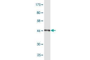Western Blot detection against Immunogen (48. (RAB7L1 antibody  (AA 1-203))