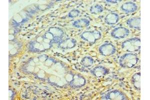Immunohistochemistry of paraffin-embedded human small intestine tissue using ABIN7148385 at dilution of 1:100 (Complement Factor H antibody  (AA 20-270))