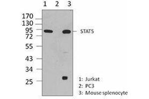 Western Blotting (WB) image for anti-Signal Transducer and Activator of Transcription 5A (STAT5A) antibody (ABIN2666295) (STAT5A antibody)