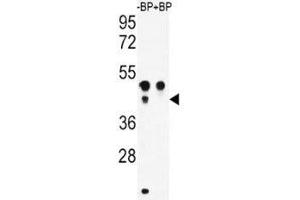 Western blot analysis of ATF4 antibody pre-incubated without (Lane 1) and with (2) blocking peptide in WiDr lysate (ATF4 antibody  (AA 220-252))