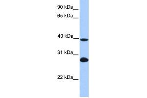 WB Suggested Anti-UBE2F Antibody Titration: 0.