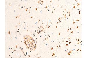 Immunohistochemistry (IHC) image for anti-Checkpoint Kinase 2 (CHEK2) (pThr68) antibody (ABIN6256592)
