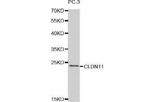Western blot analysis of extracts of PC-3 cell line, using CLDN11 antibody. (Claudin 11 antibody  (AA 26-207))