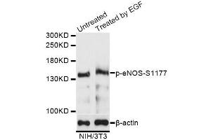 Western blot analysis of extracts of NIH/3T3 cells,using Phospho-eNOS-S1177 antibody (ABIN5995597) at 1/1000 dilution. (ENOS antibody  (pSer1177))