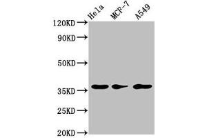 Western Blot Positive WB detected in: Hela whole cell lysate, MCF-7 whole cell lysate, A549 whole cell lysate All lanes: RCE1 antibody at 3.