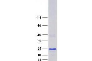 Validation with Western Blot (CNBP Protein (Transcript Variant 6) (Myc-DYKDDDDK Tag))