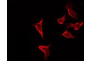 ABIN6274119 staining COLO205 by IF/ICC. (TRIM3 antibody  (Internal Region))