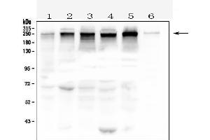 Western blot analysis of TJP1 using anti- TJP1 antibody . (TJP1 antibody  (AA 1178-1527))