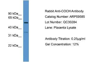WB Suggested Anti-COCH  Antibody Titration: 0. (COCH antibody  (N-Term))