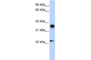 WB Suggested Anti-EN1 Antibody Titration:  0. (EN1 antibody  (C-Term))