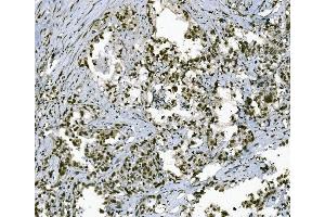 IHC analysis of TAF4 using anti-TAF4 antibody (ABIN7602114).
