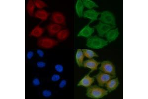 ABIN6258516 and ABIN6274735 staining Hela cells(45 min of heat-shock) by IF/ICC. (MRPL21 antibody  (Internal Region))