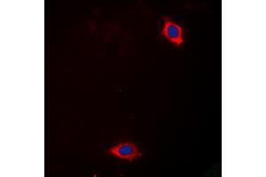 Immunofluorescent analysis of Laminin alpha 4 staining in Hela cells. (LAMa4 antibody  (Center))