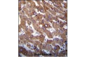 Hrk BH3 Domain Antibody (ABIN388104 and ABIN2846212) immunohistochemistry analysis in formalin fixed and paraffin embedded human liver tissue followed by peroxidase conjugation of the secondary antibody and DAB staining. (HRK antibody  (AA 15-50))