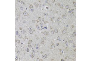 Immunohistochemistry of paraffin-embedded mouse brain using CD59 antibody (ABIN3212238) (40x lens). (CD59 antibody)
