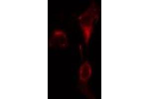 ABIN6275584 staining  A549 cells by IF/ICC. (SLC9A9 antibody  (Internal Region))