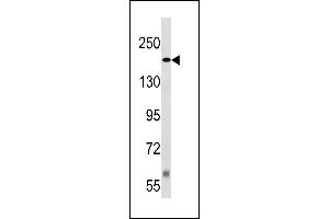 TSC2 Antibody (Center /) (ABIN1881944 and ABIN2843242) western blot analysis in Jurkat cell line lysates (35 μg/lane). (Tuberin antibody  (AA 1364-1393))