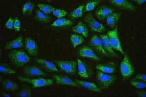 IF analysis of EIF4A using anti-EIF4A antibody (ABIN7601309). (EIF4A1 antibody  (AA 32-406))