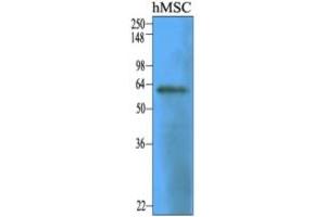 Western Blotting (WB) image for anti-5'-Nucleotidase, Ecto (CD73) (NT5E) (AA 27-252) antibody (ABIN316595) (CD73 antibody  (AA 27-252))