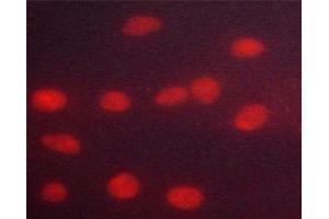 ABIN6267318 staining HeLa cells by ICC/IF. (Progesterone Receptor antibody  (pSer294))