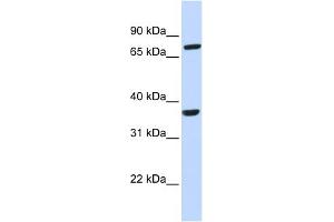 WB Suggested Anti-CCRL2 Antibody Titration:  0. (CCRL2 antibody  (N-Term))