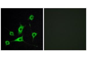 Immunofluorescence analysis of LOVO cells, using CRBP III antibody. (Retinol Binding Protein 5 antibody  (N-Term))