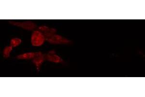 ABIN6274081 staining COLO205 cells by IF/ICC. (JMY antibody  (C-Term))