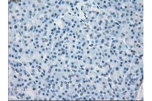 Immunohistochemical staining of paraffin-embedded colon tissue using anti-FCGR2A mouse monoclonal antibody. (FCGR2A antibody)