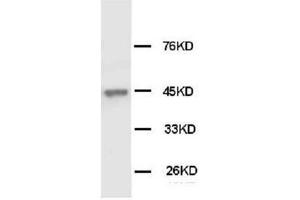 Western Blotting (WB) image for anti-Keratin 18 (KRT18) antibody (ABIN1106917) (Cytokeratin 18 antibody)