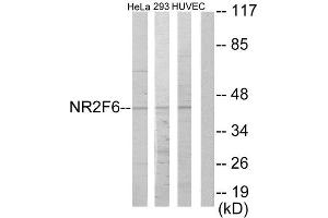 Western Blotting (WB) image for anti-Nuclear Receptor Subfamily 2, Group F, Member 6 (NR2F6) (N-Term) antibody (ABIN1849146)