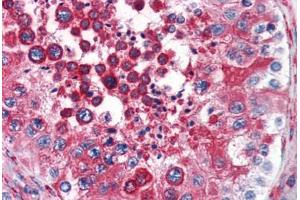 Human Testis (formalin-fixed, paraffin-embedded) stained with RTN4 antibody ABIN343914 at 3 ug/ml followed by biotinylated goat anti-rabbit IgG secondary antibody ABIN481713, alkaline phosphatase-streptavidin and chromogen. (Reticulon 4 antibody  (N-Term))