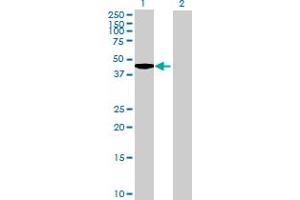 Western Blot analysis of LCORL expression in transfected 293T cell line by LCORL MaxPab polyclonal antibody.