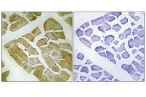 Immunohistochemistry analysis of paraffin-embedded human skeletal muscle tissue using MYH4 antibody. (MYH4 antibody  (C-Term))