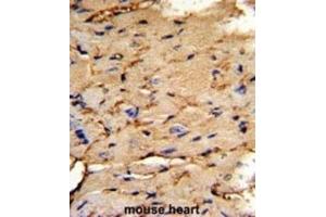 Immunohistochemistry (IHC) image for anti-phosphoprotein Enriched in Astrocytes 15 (PEA15) antibody (ABIN3003786) (PEA15 antibody)