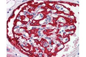 Immunohistochemistry (IHC) image for anti-F-Box and WD Repeat Domain Containing 7 (FBXW7) (C-Term) antibody (ABIN2782955) (FBXW7 antibody  (C-Term))
