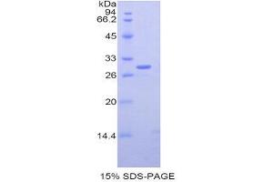 SDS-PAGE (SDS) image for Nucleolin (NCL) (AA 353-568) protein (His tag) (ABIN1878448)